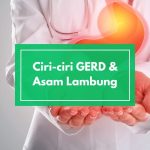 Ciri-ciri GERD dan Cara Alami Mengatasinya